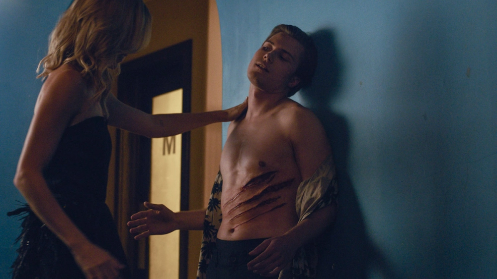 ảnh poster phim Điên rồ (Rabid)