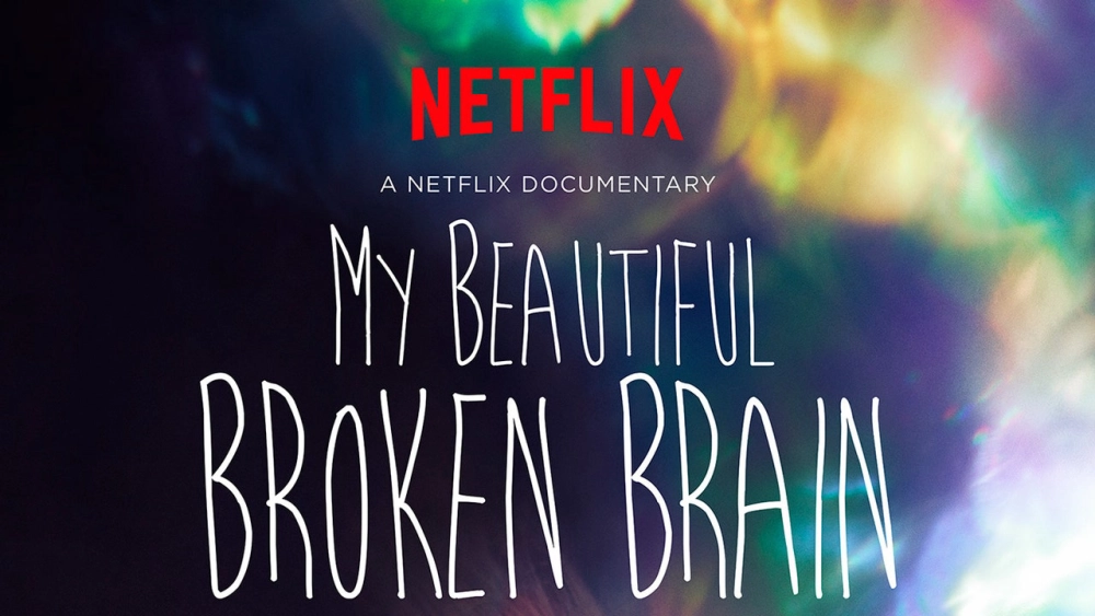 ảnh poster phim Khối óc xinh đẹp tội nghiệp của tôi (My Beautiful Broken Brain)