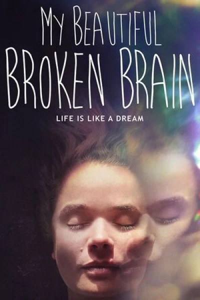 Khối óc xinh đẹp tội nghiệp của tôi (My Beautiful Broken Brain)