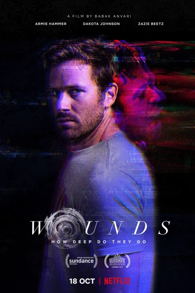 Tổn thương (Wounds)
